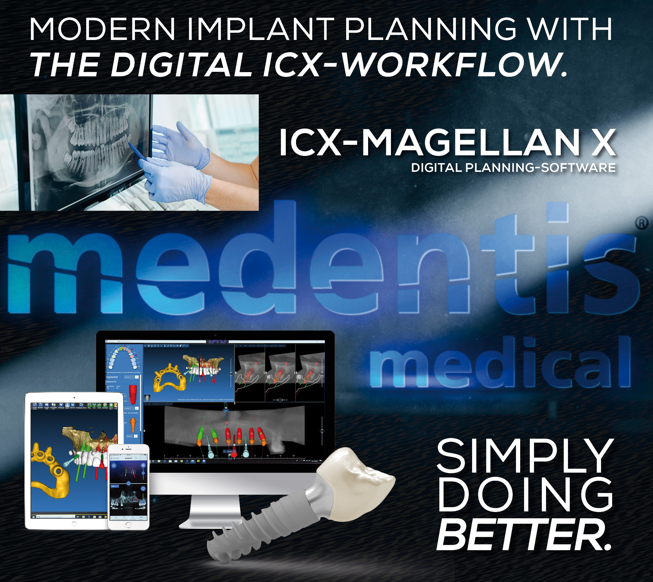 ICX-P5 Intraoral Scanner